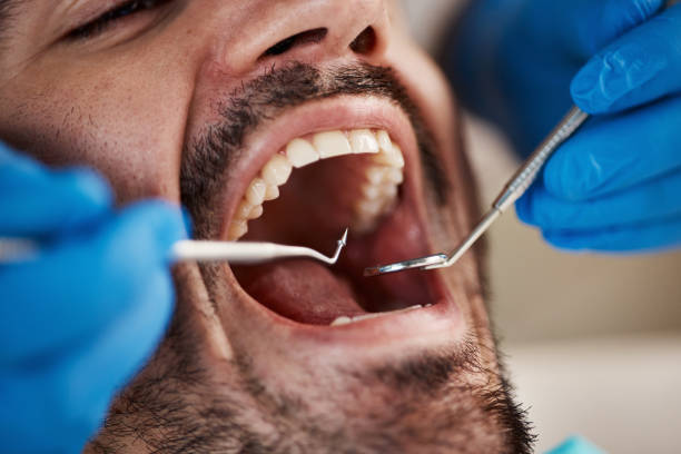 Best Emergency Root Canal Treatment in Constantine, MI